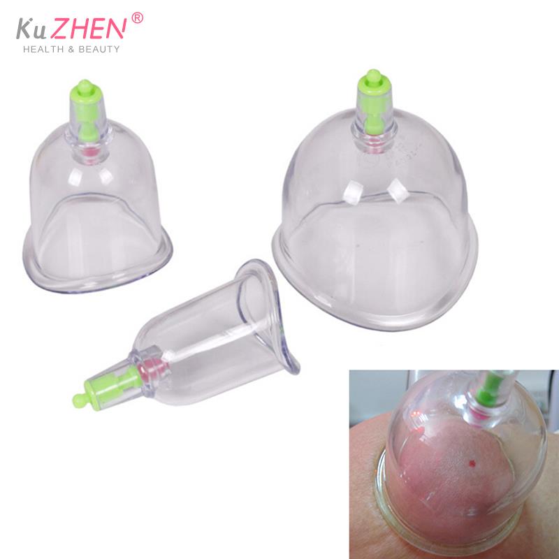 伝統的な 3 カップ kangzhu u 湾曲した真空吸引関 - Medical Lab Science のレビューと価格